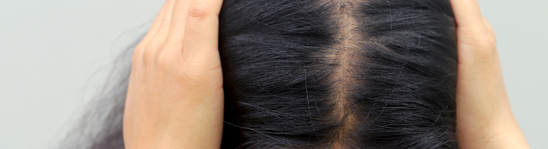 O Verdadeiro Motivo Pelo Qual Seu Cabelo Não Para de Cair