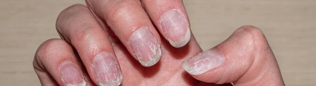 O que está por trás da Queda de Cabelo, Pele Sem Vida e Unhas Fracas?