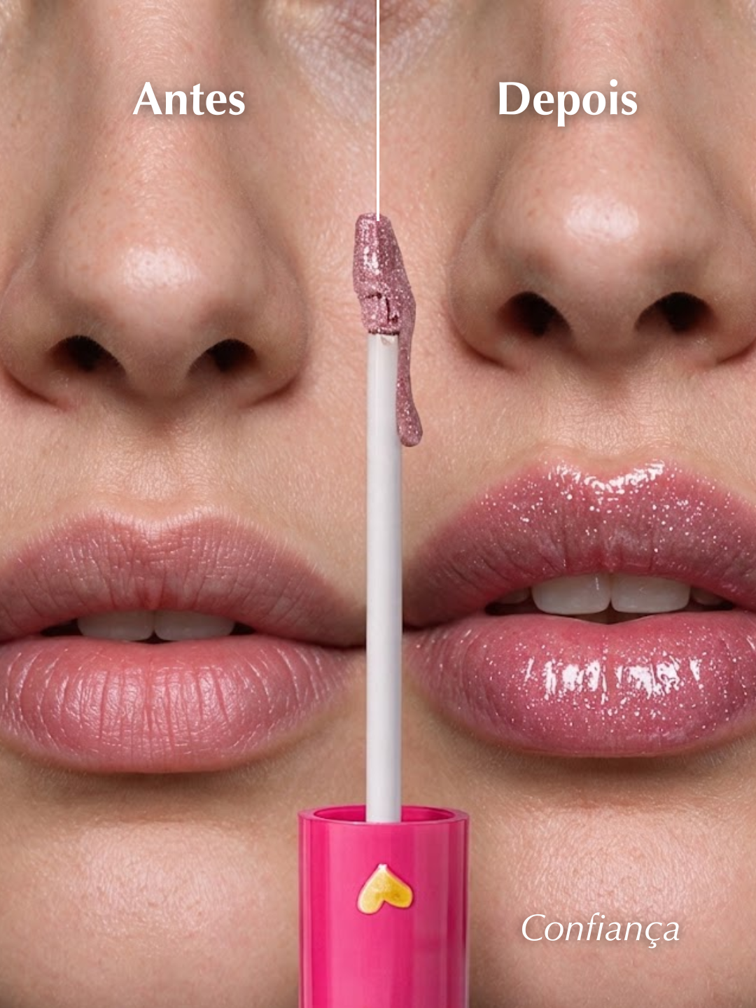 Gloss Labial 4ml com Ácido Hialurônico e Brilho - Sonia Hernandes