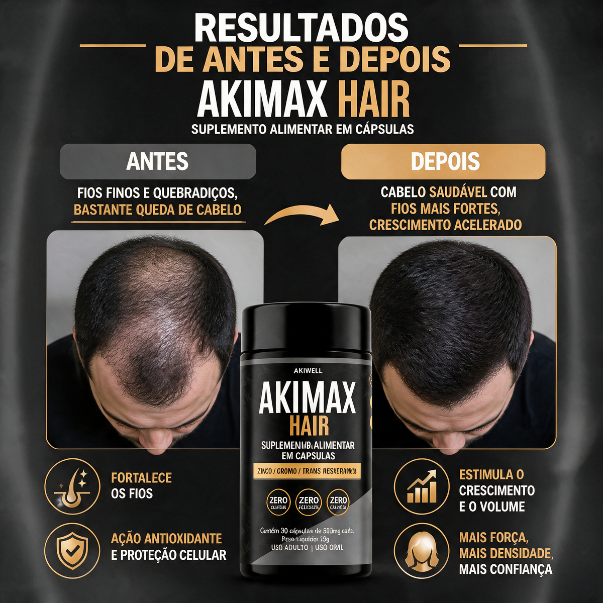 Akimax Hair - Crescimento Capilar